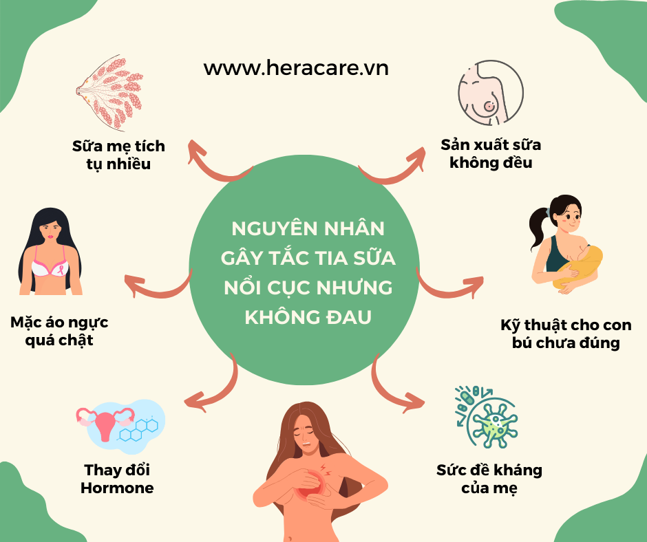 nguyên nhân gây tắc tia sữa nổi cục nhưng không đau