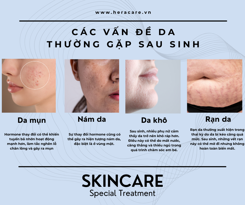 các vấn đề thường gặp về da sau sinh em bé