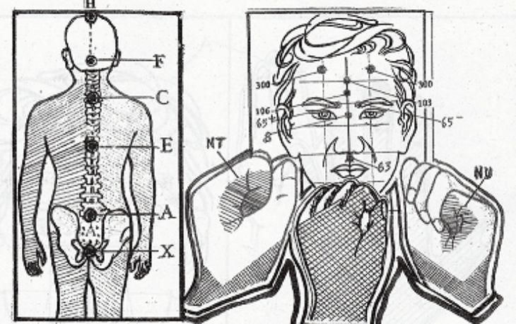 hướng dẫn chữa rối loạn tiền đình bằng phương pháp diện chẩn